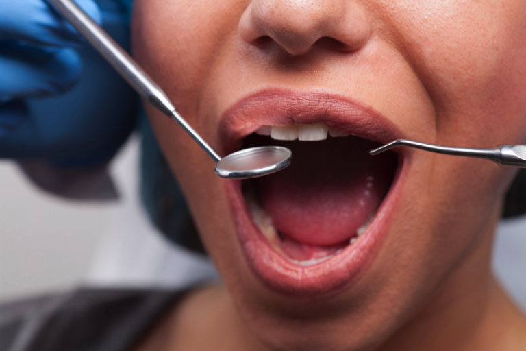 Oral Bone Grafting A Basic Guide OMSNashville TN