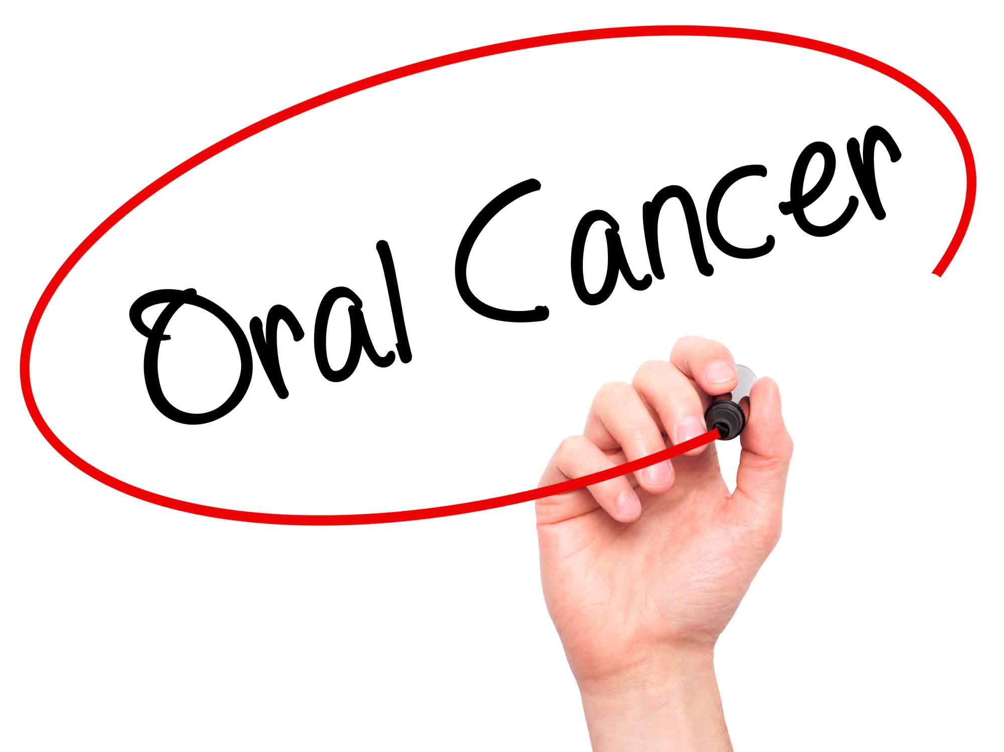 Common Questions About Oral Cancer Omsnashville Tn 7673